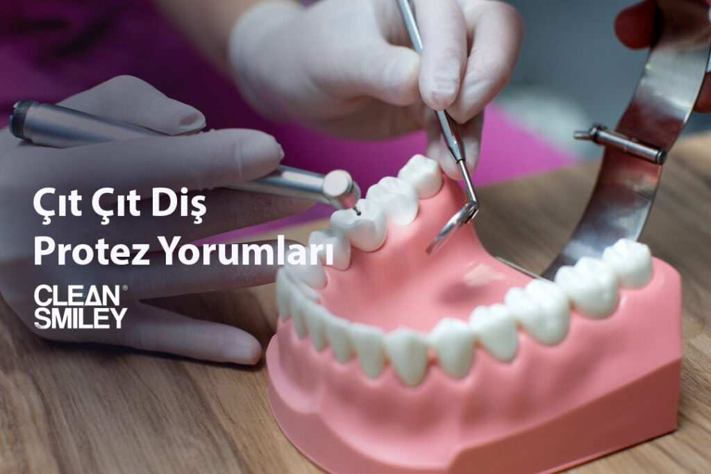 Çıt Çıt Diş Protez Yorumları