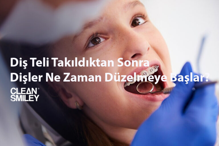 Diş Teli Takıldıktan Sonra Dişler Ne Zaman Düzelmeye Başlar?