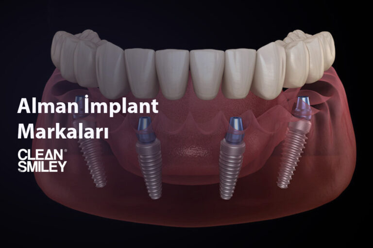 Alman İmplant Markaları