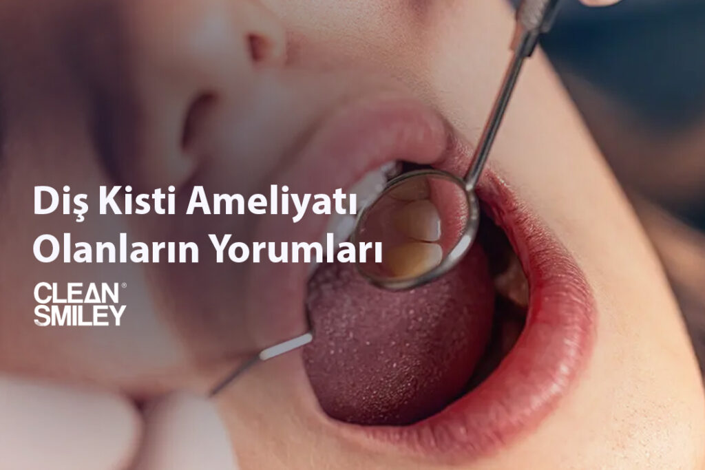Diş Kisti Ameliyatı Olanların Yorumları