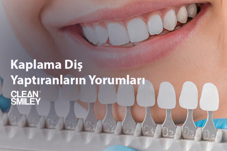 Kaplama Diş Yaptıranların Yorumları