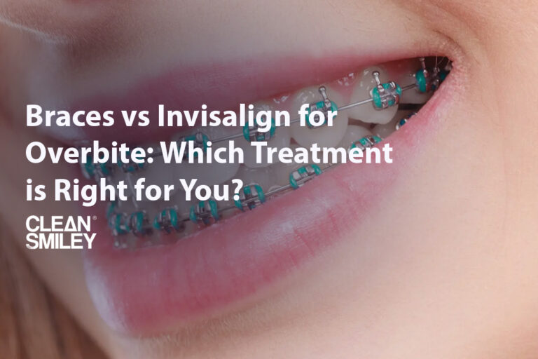 Braces vs Invisalign for Overbite Which Treatment is Right for You