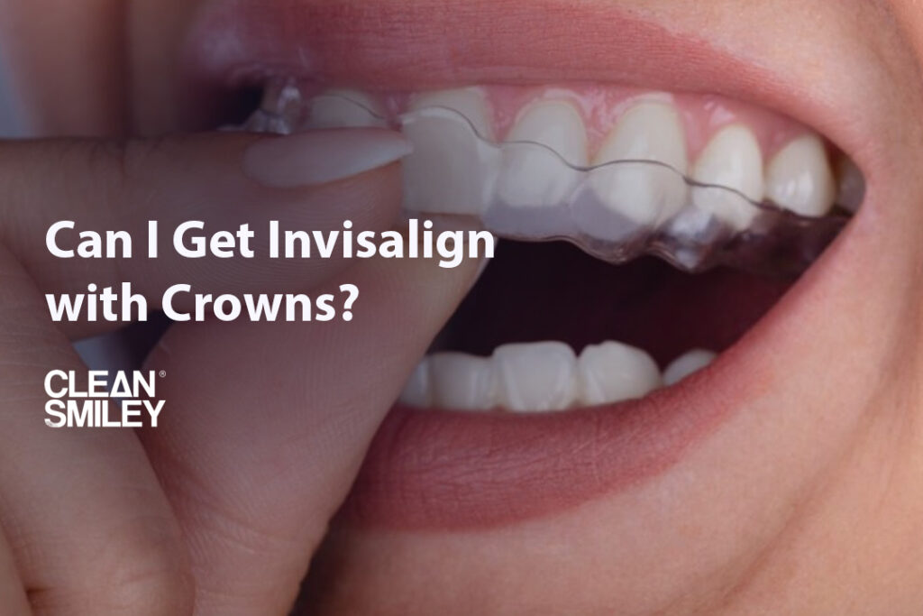 Can I Get Invisalign with Crowns