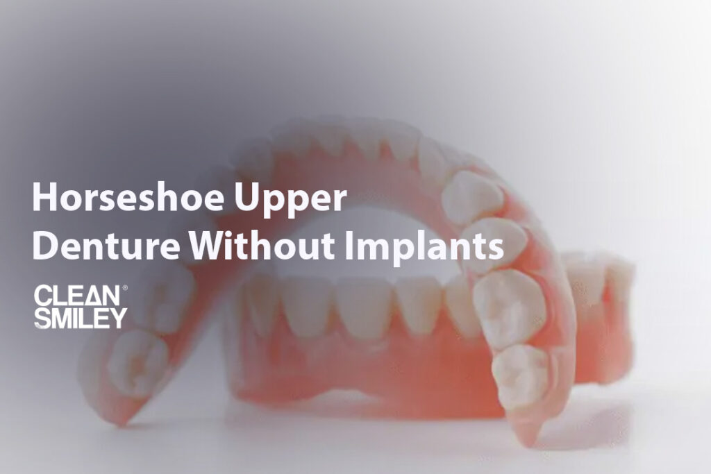 Horseshoe Upper Denture Without Implants