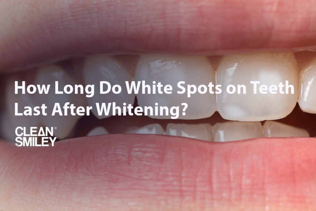 Clean Smiley Turkey cover image with a close-up of front teeth, illustrating how long white spots on teeth after whitening usually last
