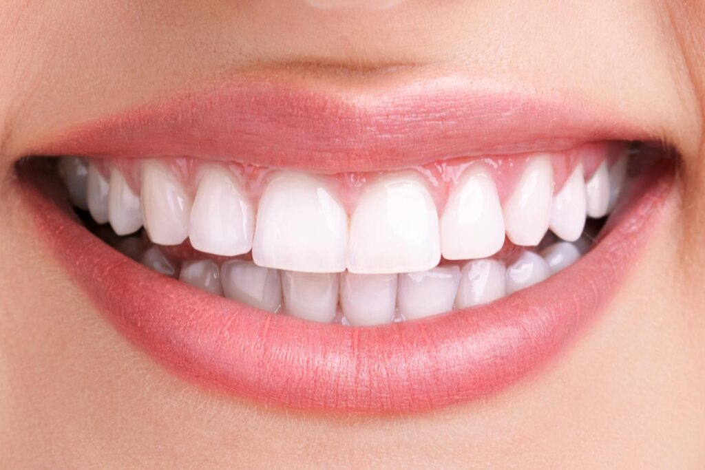 Close-up of a smile with crowns, related to whether the dentist is responsible for a failed crown