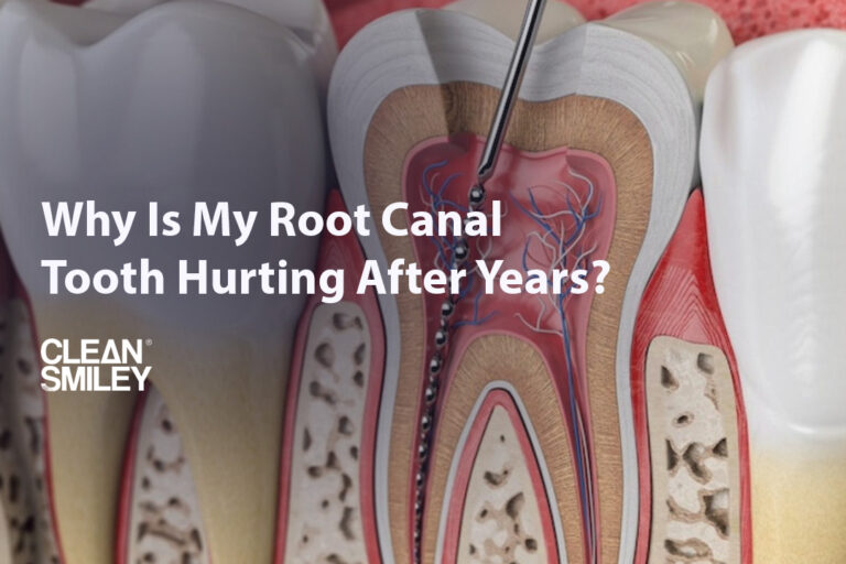 Why Is My Root Canal Tooth Hurting After Years?