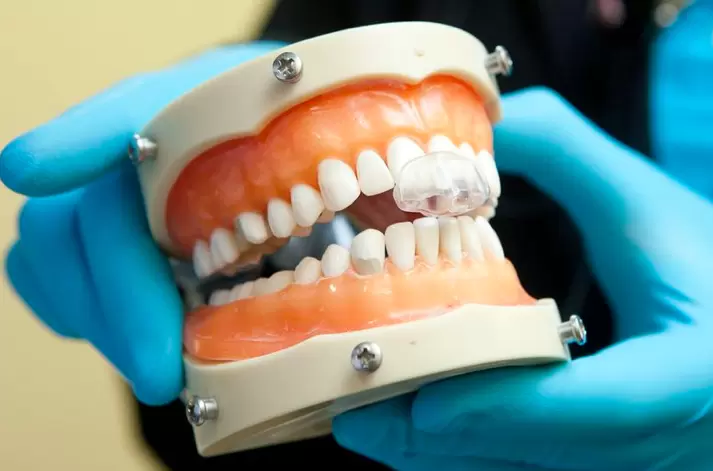 Teeth Protectors for Grinding Teeth