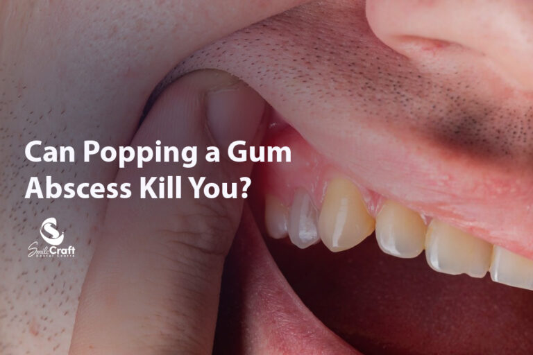 Can Popping a Gum Abscess Kill You