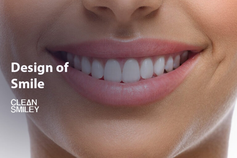 Design of Smile