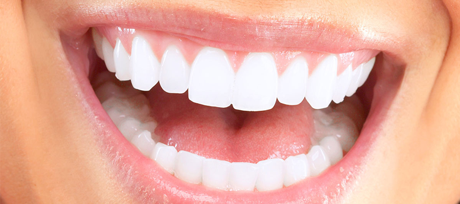 Hollywood Smile