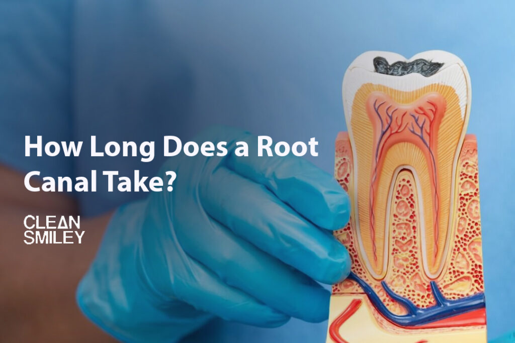 How Long Does a Root Canal Take