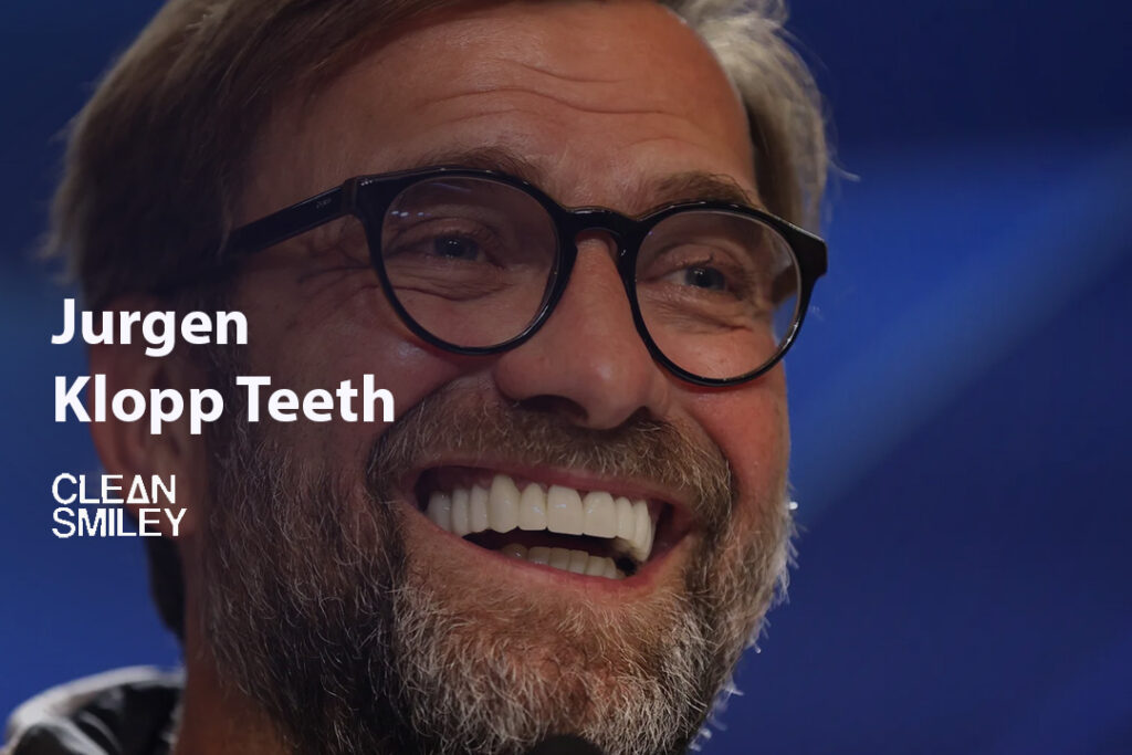 Jurgen Klopp Teeth