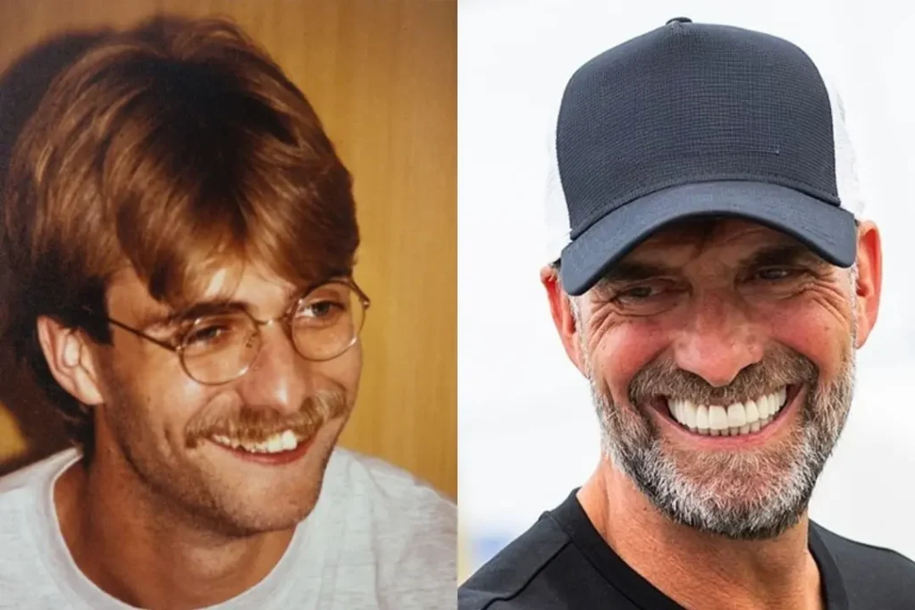 Jurgen Klopp Teeth