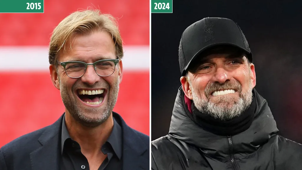 Jurgen Klopp Teeth