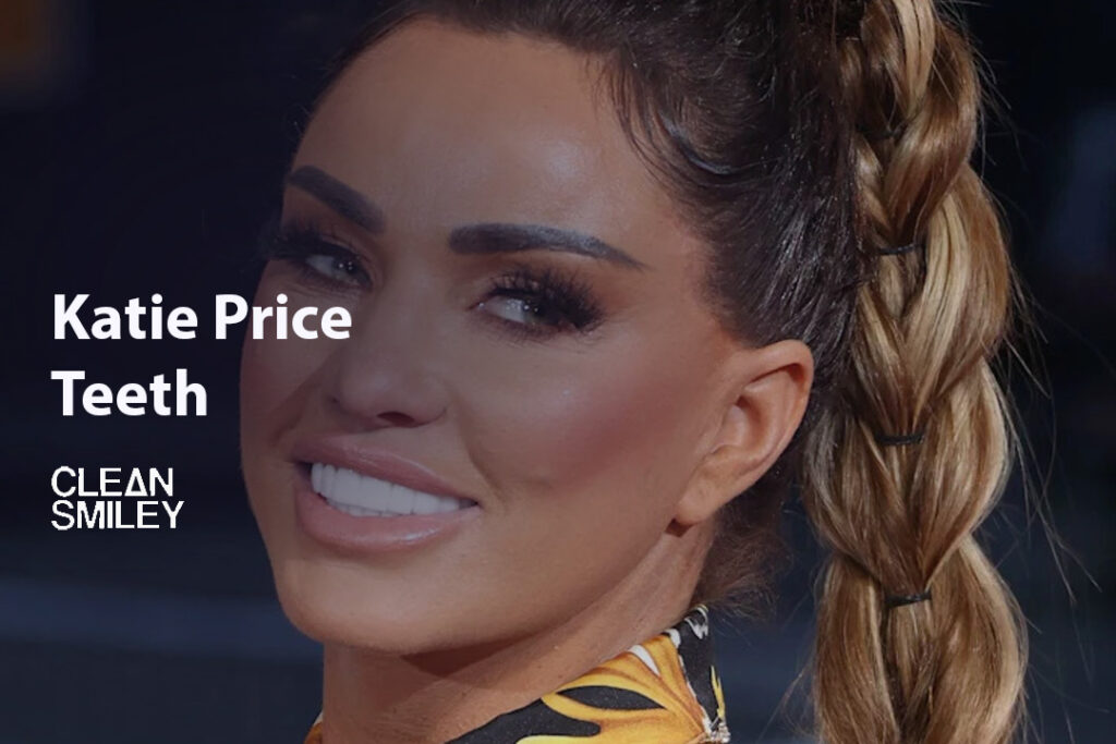 Katie Price Teeth