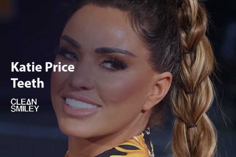 Katie Price Teeth