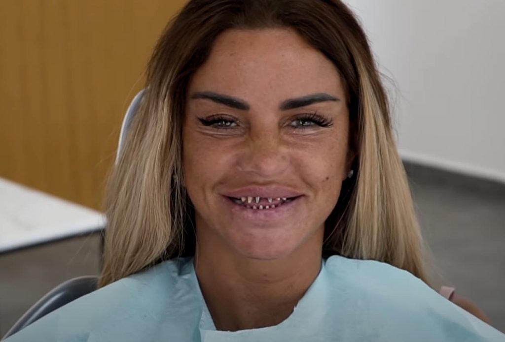 Katie Price Teeth