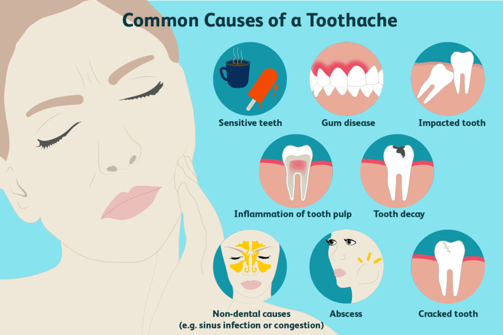 Teeth Pain How to Stop