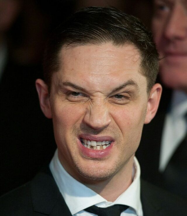 Tom Hardy's Teeth 1
