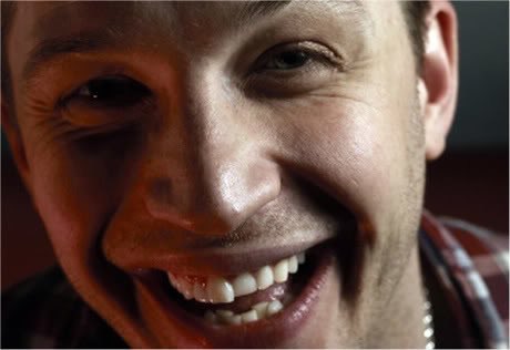 Tom Hardy's Teeth 2