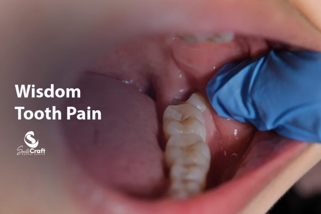 Wisdom Tooth Pain
