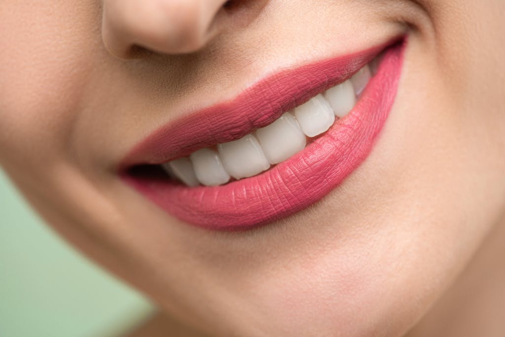 Виниры в Турции — до и после установки в клинике Clean Smiley Turkey в Анталии